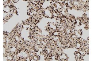 ABIN6273020 at 1/100 staining Rat lung tissue by IHC-P. (TIA1 anticorps  (Internal Region))