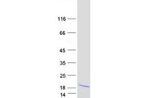 Validation with Western Blot