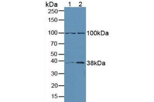Western blot analysis of (1) Human A549 Cells and (2) Human Lung Tissue. (ERK1 anticorps  (AA 75-312))