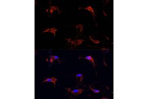 Immunofluorescence analysis of C6 cells using FBN1 Polyclonal Antibody (ABIN7267176) at dilution of 1:100 (40x lens). (Fibrillin 1 anticorps  (AA 360-460))