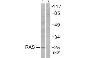 Western blot analysis of extracts from HeLa cells, using RASH/RASK/RASN antibody (ABIN5976497). (RASH/RASK/RASN (N-Term) anticorps)