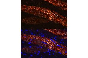 Immunofluorescence analysis of rat brain using Neurofilament L Rabbit pAb (ABIN3020808, ABIN3020809, ABIN3020810 and ABIN6213733) at dilution of 1:100 (40x lens). (NEFL anticorps  (AA 400-543))