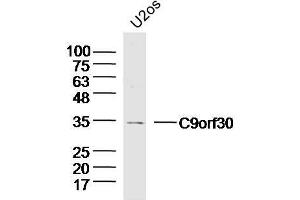 Lane 1: U2-OS lysates probed with C9orf30 Polyclonal Antibody, Unconjugated  at 1:300 overnight at 4˚C. (MSANTD3 anticorps  (AA 1-100))