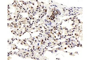 Immunohistochemistry analysis of paraffin-embedded Rat lung using LEP Polyclonal Antibody at dilution of 1:100.