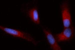 Immunofluorescence (IF) image for anti-Immunoglobulin Binding Protein (BIP) (AA 20-650) antibody (PE) (ABIN5566443) (BIP anticorps  (AA 20-650) (PE))