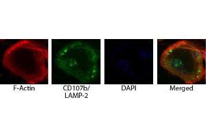 Osteoclasts from ashen mice were stained with AF594 conjugated phalloidin and Rat Anti-Mouse CD107b-UNLB (LAMP2 anticorps)