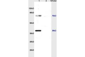 Lane 1: rat brain lysates Lane 2: rat kidney lysates probed with Anti ZNF185 Polyclonal Antibody, Unconjugated (ABIN762716) at 1:200 in 4 °C. (Zinc Finger Protein 185 anticorps  (AA 551-650))