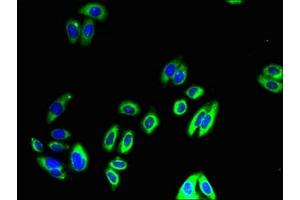 Immunofluorescent analysis of HepG2 cells using ABIN7149960 at dilution of 1:100 and Alexa Fluor 488-congugated AffiniPure Goat Anti-Rabbit IgG(H+L)