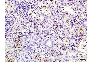 Formalin-fixed and paraffin embedded mouse lung labeled with Rabbit Anti pro-caspase-3 Polyclonal Antibody, Unconjugated (ABIN747728) at 1:200 followed by conjugation to the secondary antibody and DAB staining (Caspase 3 anticorps  (AA 11-120))