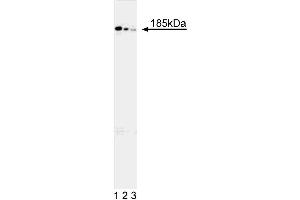 Western blot analysis of human DCC protein in 293 human embryonic kidney cells stably transfected with an expression vector containing full length DCC cDNA. (DCC anticorps)