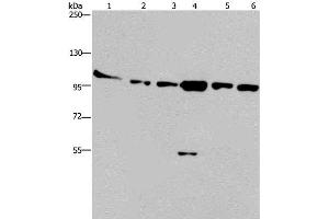 Western Blot analysis of Human testis tissue, K562, A549, Raji, NIH/3T3 and Hela cell using PRKD3 Polyclonal Antibody at dilution of 1:200 (PRKD3 anticorps)