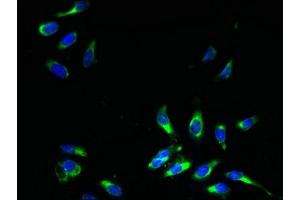 Immunofluorescent analysis of Hela cells using ABIN7164554 at dilution of 1:100 and Alexa Fluor 488-congugated AffiniPure Goat Anti-Rabbit IgG(H+L) (SLC31A2 anticorps  (AA 44-93))