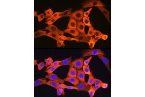 Immunofluorescence analysis of NIH-3T3 cells using JNK1/JNK3 Rabbit mAb (ABIN1678909, ABIN7101754, ABIN7101755 and ABIN7101756) at dilution of 1:100 (40x lens). (JNK anticorps)