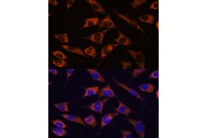 Immunofluorescence analysis of L929 cells using MMP25 antibody (ABIN7268422) at dilution of 1:100. (MMP25 anticorps  (AA 350-540))