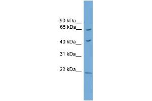 WB Suggested Anti-Tbx18 Antibody Titration:  0. (T-Box 18 anticorps  (Middle Region))