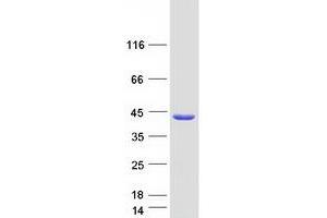 Validation with Western Blot