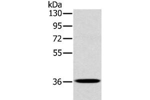 Western Blot analysis of A172 cell using CLP36 Polyclonal Antibody at dilution of 1:400 (PDLIM1 anticorps)