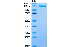 Human ENPP-3 on Tris-Bis PAGE under reduced condition.