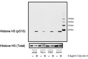 Western Blotting (WB) image for anti-Histone H3 (H3) (pSer10) antibody (ABIN7449558)