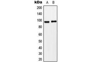 Western blot analysis of Matriptase expression in HeLa (A), SW620 (B) whole cell lysates. (ST14 anticorps  (N-Term))