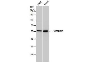WB Image Vimentin antibody detects Vimentin protein by western blot analysis. (Vimentin anticorps)