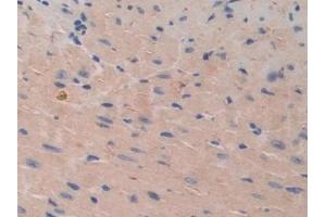 Detection of CDH16 in Mouse Heart Tissue using Polyclonal Antibody to Cadherin 16 (CDH16)