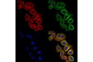 ABIN6261515 and ABIN6278456 staining Hela cells by IF/ICC.