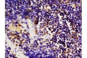 anti-Mitogen-Activated Protein Kinase Kinase Kinase Kinase 1 (MAP4K1) (pSer171) antibody