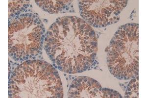 Detection of ITGaV in Mouse Testis Tissue using Polyclonal Antibody to Integrin Alpha V (ITGaV)