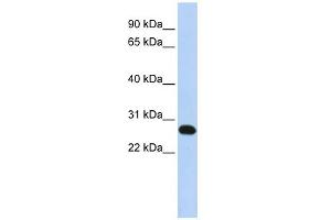 WB Suggested Anti-FAM119A Antibody Titration: 0. (FAM119A anticorps  (N-Term))