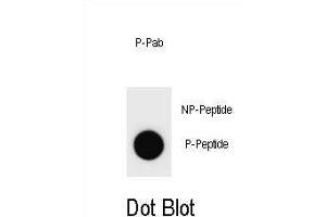 Dot blot analysis of Rat CCNB3 Antibody (Phospho ) Phospho-specific Pab (ABIN1881170 and ABIN2850538) on nitrocellulose membrane. (Cyclin B3 anticorps  (pSer283))