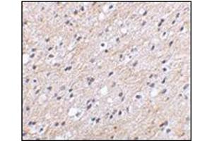 Immunohistochemical staining of human brain tissue using AP30597PU-N at 2. (NIPSNAP1 anticorps  (Center))