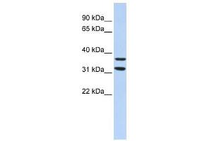 ZNF254 antibody used at 1. (ZNF254 anticorps  (Middle Region))