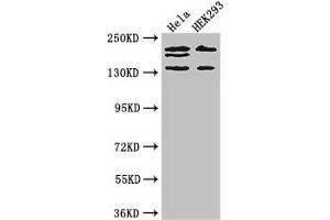 Western Blot Positive WB detected in: Hela whole cell lysate, HEK293 whole cell lysate All lanes: ITSN2 antibody at 4 μg/mL Secondary Goat polyclonal to rabbit IgG at 1/50000 dilution Predicted band size: 194, 191, 142, 136 kDa Observed band size: 194, 191, 142 kDa (Intersectin 2 anticorps  (AA 940-1209))