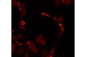 ABIN6275341 staining HuvEc by IF/ICC.