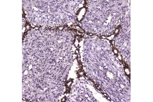 IHC analysis of Glutathione Reductase using anti-Glutathione Reductase antibody .