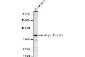 Western blot analysis of extracts of Mouse testis, using Androgen Receptor antibody (ABIN3022797, ABIN3022798, ABIN3022799 and ABIN6219233) at 1:668 dilution. (Androgen Receptor anticorps)