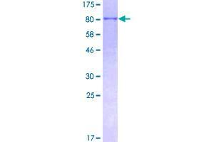 Image no. 1 for Tripartite Motif Containing 25 (TRIM25) (AA 1-630) protein (GST tag) (ABIN1323635)