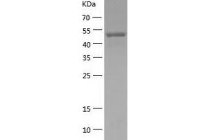Western Blotting (WB) image for Zinc Finger and BTB Domain Containing 9 (ZBTB9) (AA 1-473) protein (His-IF2DI Tag) (ABIN7125767)