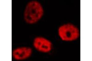 ABIN6272401 staining HeLa by IF/ICC. (PRPF31 anticorps  (Internal Region))