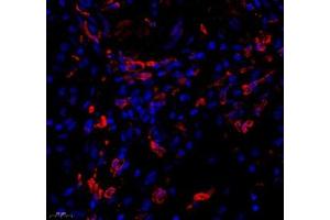 Immunofluorescence of paraffin embedded human kidney using KCTD19 (ABIN7075147) at dilution of 1: 500 (450x lens) (KCTD19 anticorps)