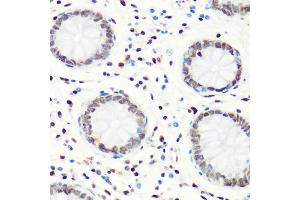 Immunohistochemistry of paraffin-embedded human colon using MonoMethyl-Histone H4-R3 antibody (ABIN1680263, ABIN1680264, ABIN6220110 and ABIN6220114) at dilution of 1:100 (40x lens).