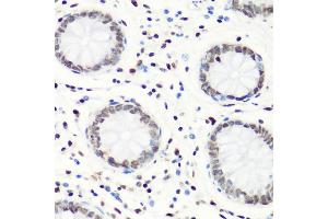 Immunohistochemistry of paraffin-embedded human colon using MonoMethyl-Histone H4-R3 antibody (ABIN1680263, ABIN1680264, ABIN6220110 and ABIN6220114) at dilution of 1:100 (40x lens). (Histone H4 anticorps  (meArg3))