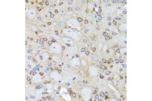 Immunohistochemistry of paraffin-embedded rat brain using ACTR2 antibody (ABIN2560930) at dilution of 1:100 (40x lens). (ACTR2 anticorps)