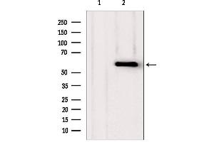Western blot analysis of extracts from various samples, using PHGDH antibody. (PHGDH anticorps  (N-Term))