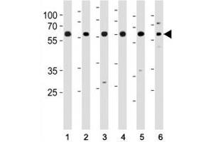 HDAC1 antibody western blot analysis of (1) HeLa, (2) K562, (3) mouse NIH3T3 cell line and (4) mouse testis, (5) rat testis and (6) rat spleen tissue lysate.