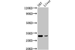 Western Blot Positive WB detected in: U87 whole cell lysate, Rat liver tissue All lanes: ITM2B antibody at 4. (RHCG anticorps  (AA 416-479))