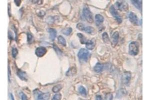 Immunohistochemical staining of formalin-fixed paraffin-embedded human skin tissue with ADAMTS2 polyclonal antibody  at 1 : 200 dilution. (Adamts2 anticorps  (C-Term))