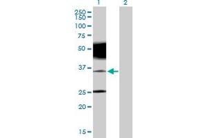 PRRT2 anticorps  (AA 1-340)