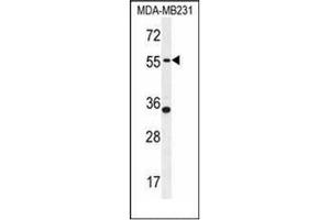 Western blot analysis of PDE12 Antibody (C-term) in MDA-MB231 cell line lysates (35ug/lane). (PDE12 anticorps  (C-Term))